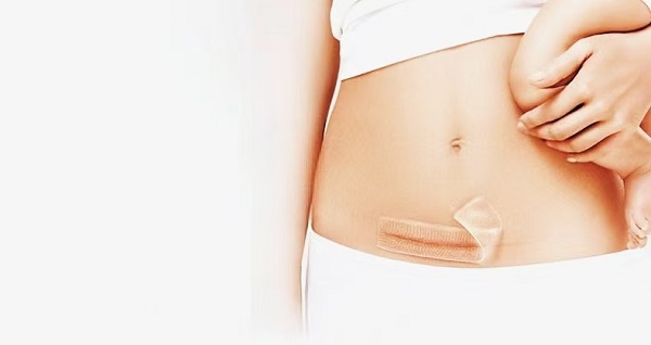 Niyə qalın silikon gel çapıq təbəqələri bu qədər populyardır?