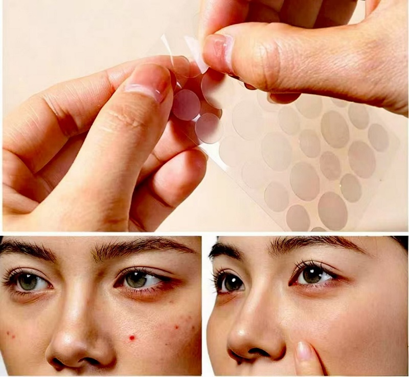 Maksimum nəticə əldə etmək üçün bir gecədə CmallBio Pimple Patches istifadə etmək olar?