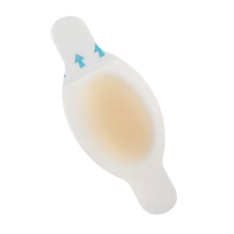 Ayaq blisterinin qarşısının alınması üçün suya davamlı hidrokolloid bandajlar